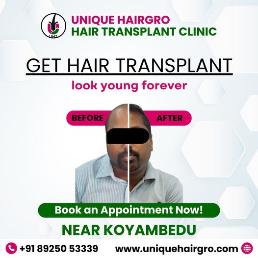 Best hair care clinic chennai