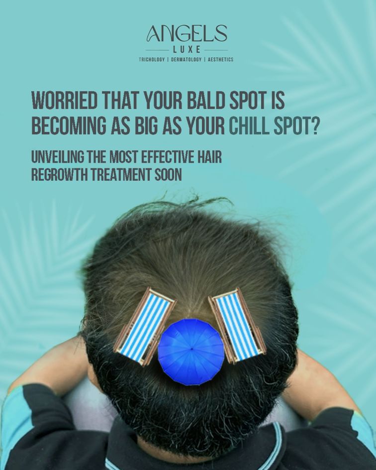 hair transplant in hyderabad | +91 99593 41999 | Angels Luxe