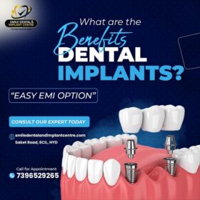 dental-implants1