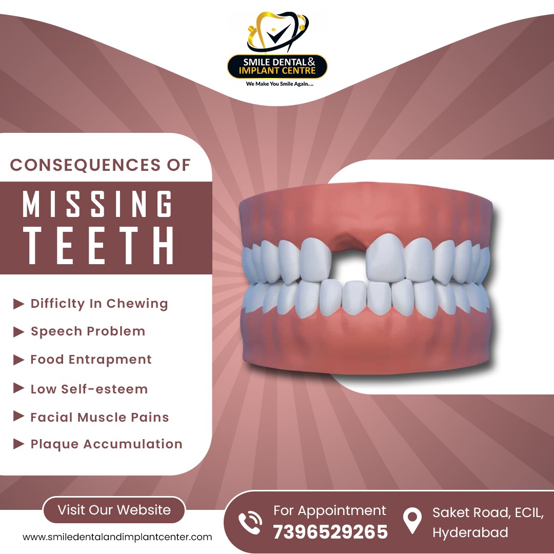 MISSING A TOOTH? DONT IGNORE THE HIDDEN RISKS!