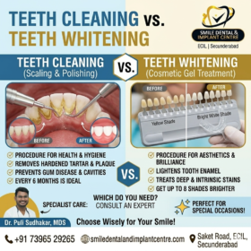 Teeth-Cleaning-1