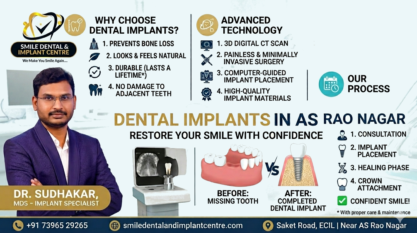 BEST DENTAL IMPLANTS IN AS RAO NAGAR – PERMANENT TOOTH REPLACEMENT