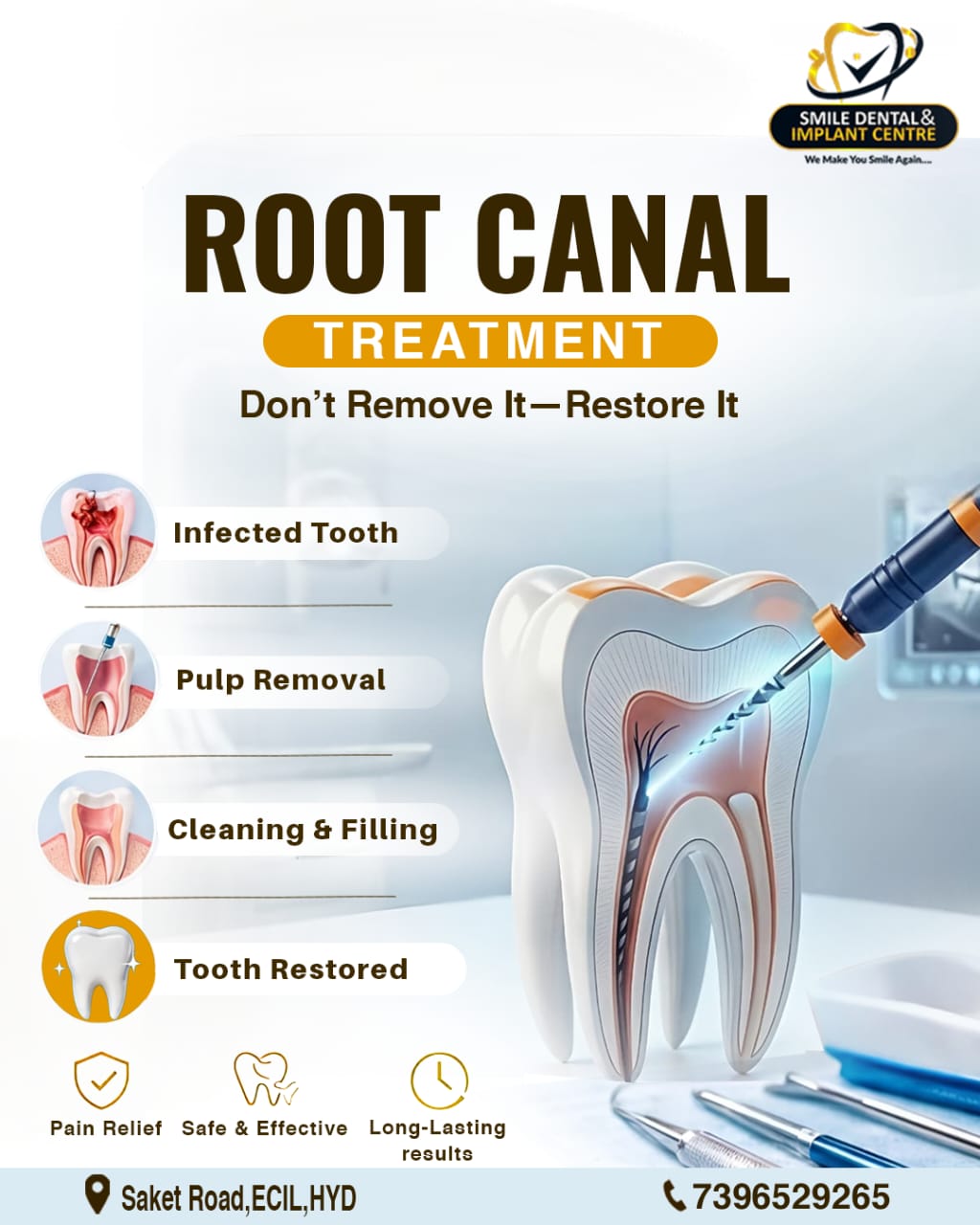 SAY GOODBYE TO TOOTHACHE! PAINLESS ROOT CANAL TREATMENT