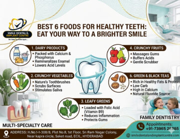 Dental-tips