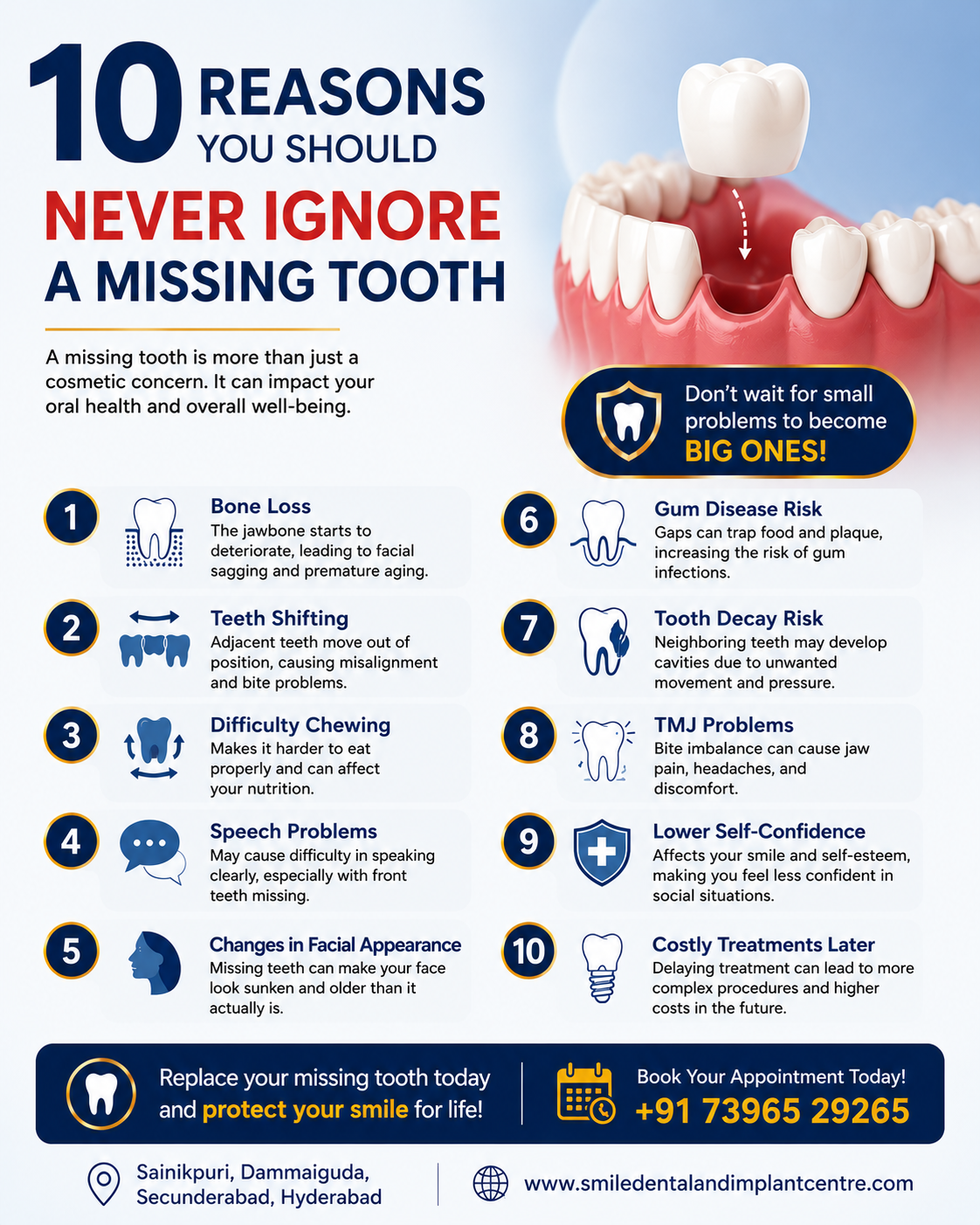 10 Reasons You Should Never Ignore a Missing Tooth