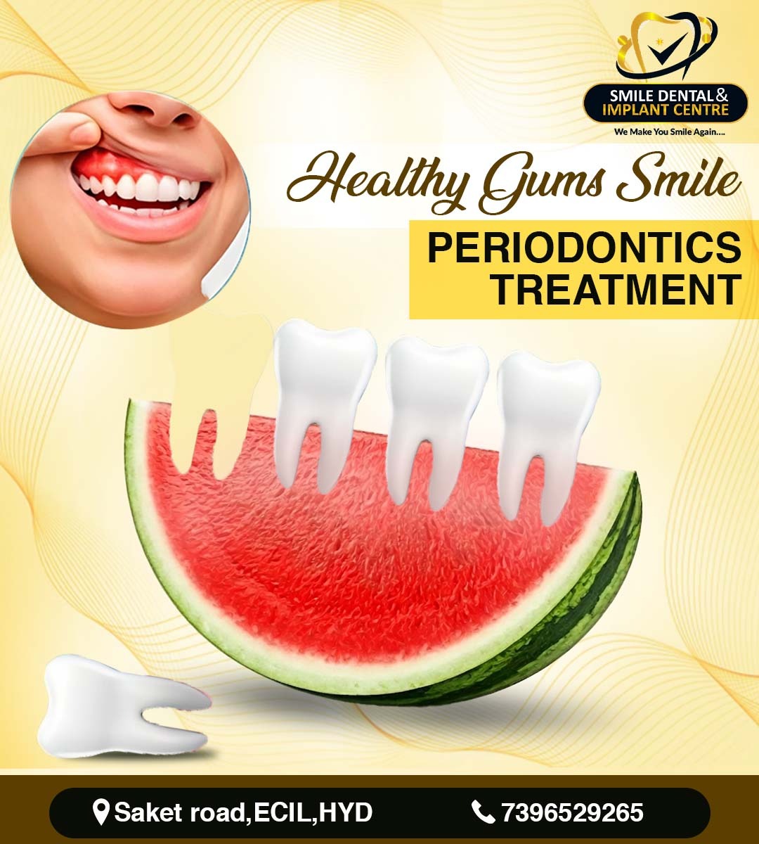 Healthy Gums, Healthy Smile: Comprehensive Periodontics Treatment in Secunderabad