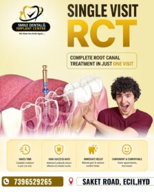 Sigle-visit-Root-Canal
