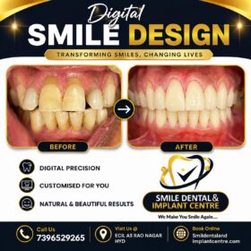 Smile-Design