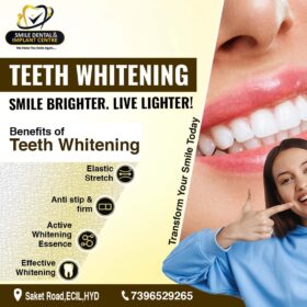 Teeth-Whitening